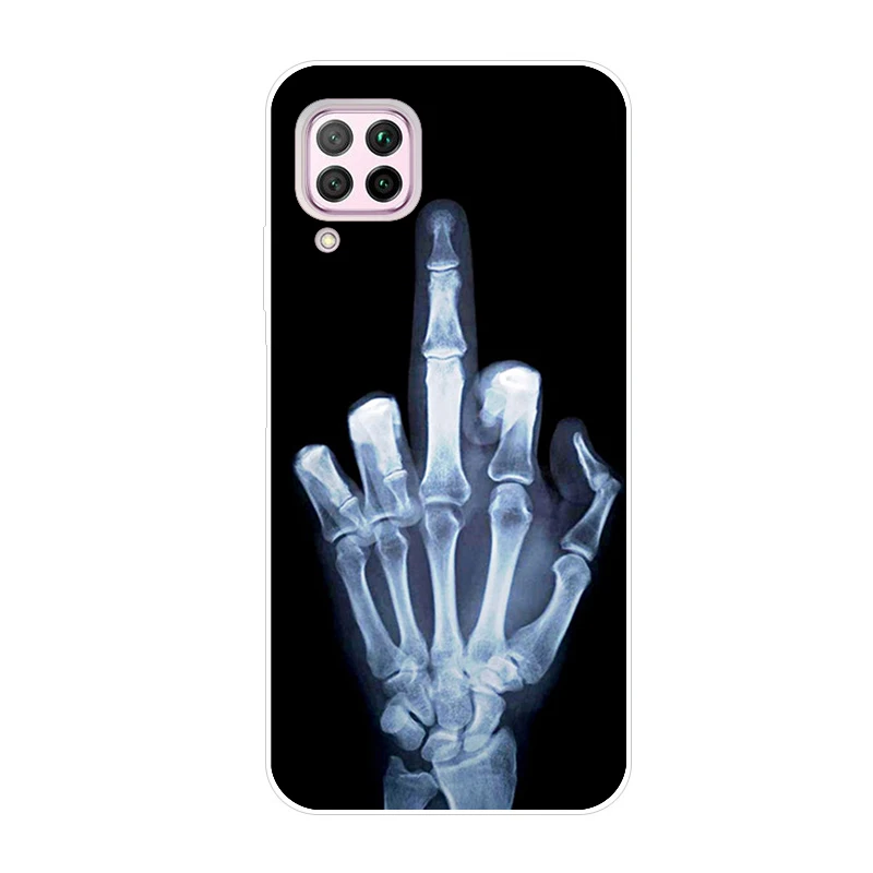 Phone Case for Huawei Honor 6A Covers Cover 3D TPU Soft Silicone fundas Bag 5.0&quot Cases | Мобильные телефоны и