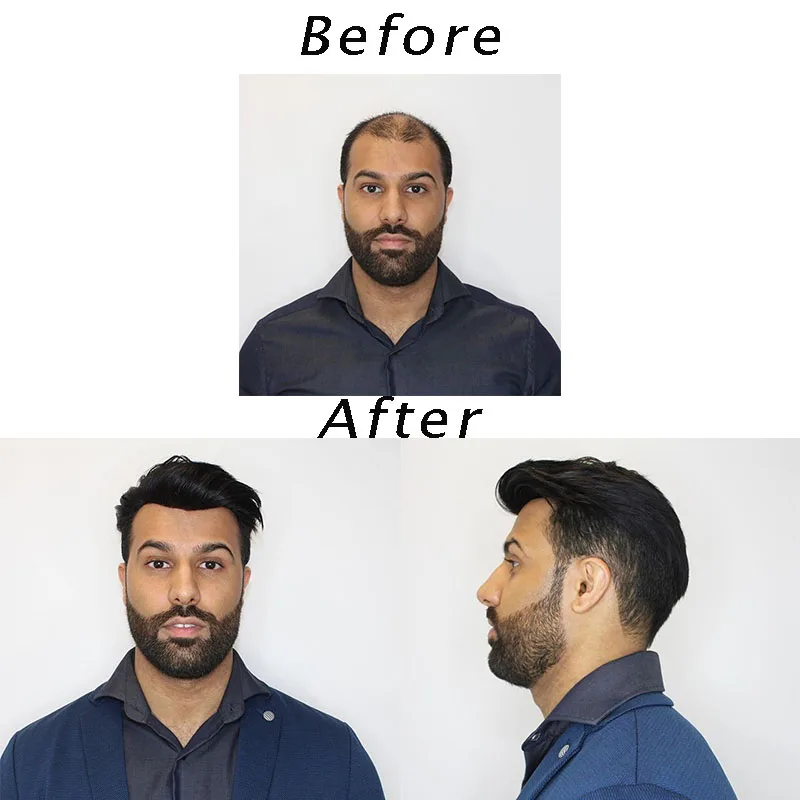 Синтетические волосы на кружеве PU вокруг Для Мужчин's накладки из искусственных