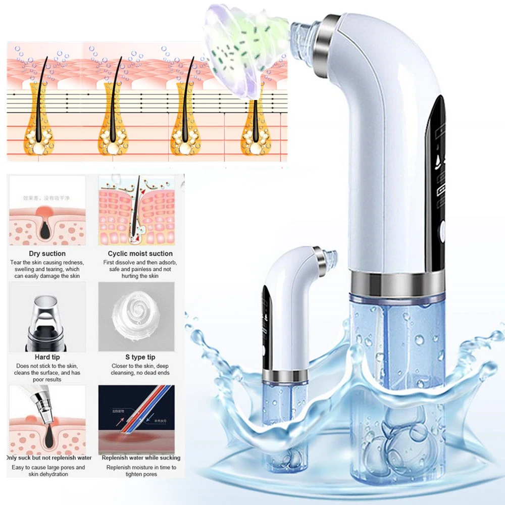 Домашний Применение Электрический вакуумный угорь очиститель пор круговорот