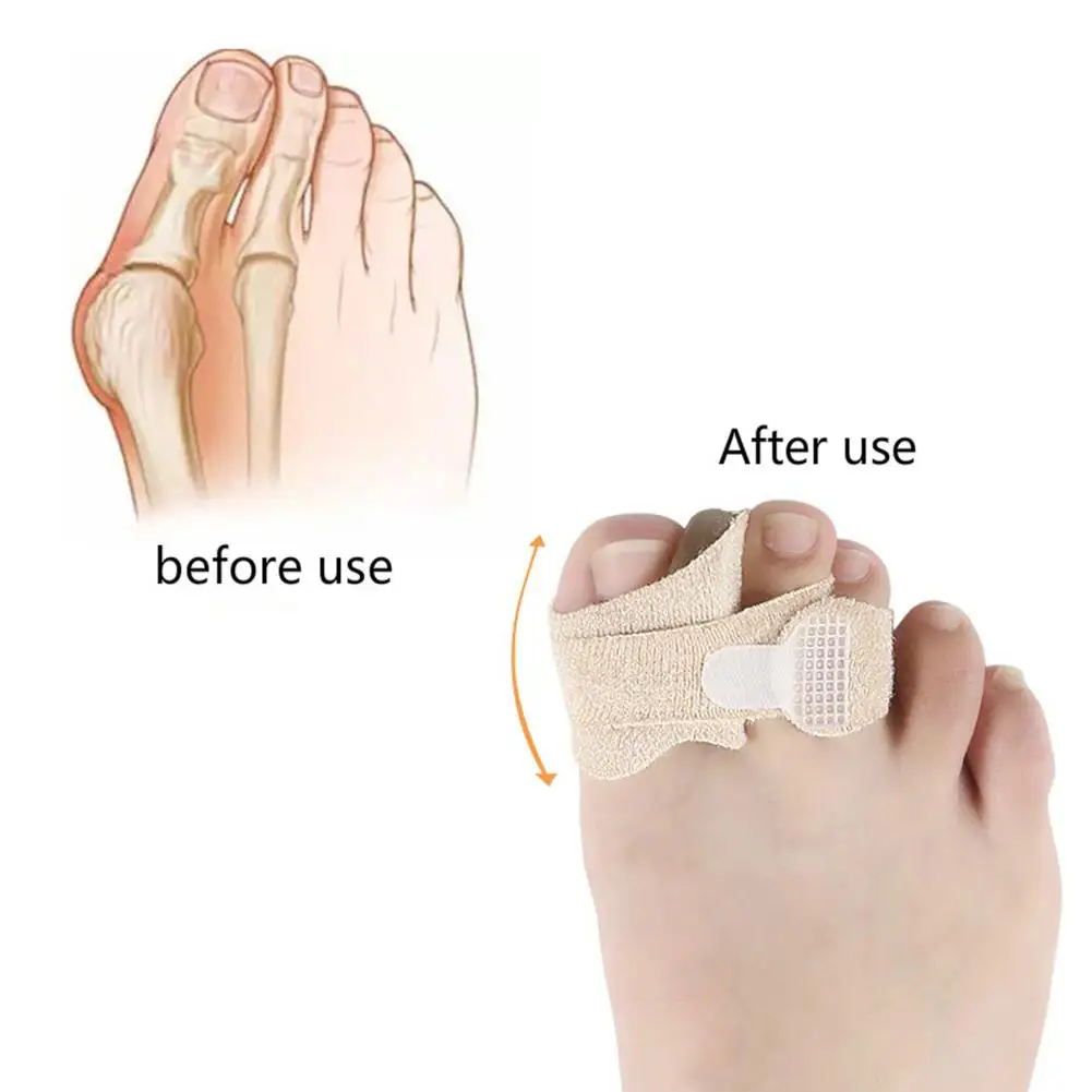 Ортопедические носки для коррекции вальгусной деформации большого пальца ног