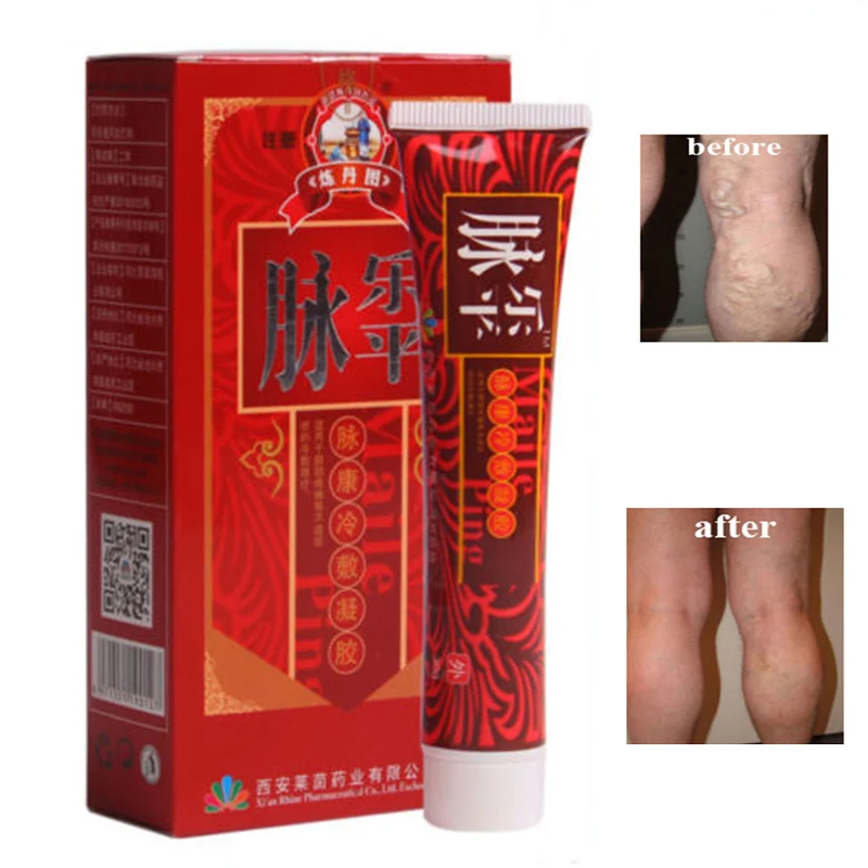1 шт. травяной крем для удаления боли в венах|Пластыри терапевтические| |
