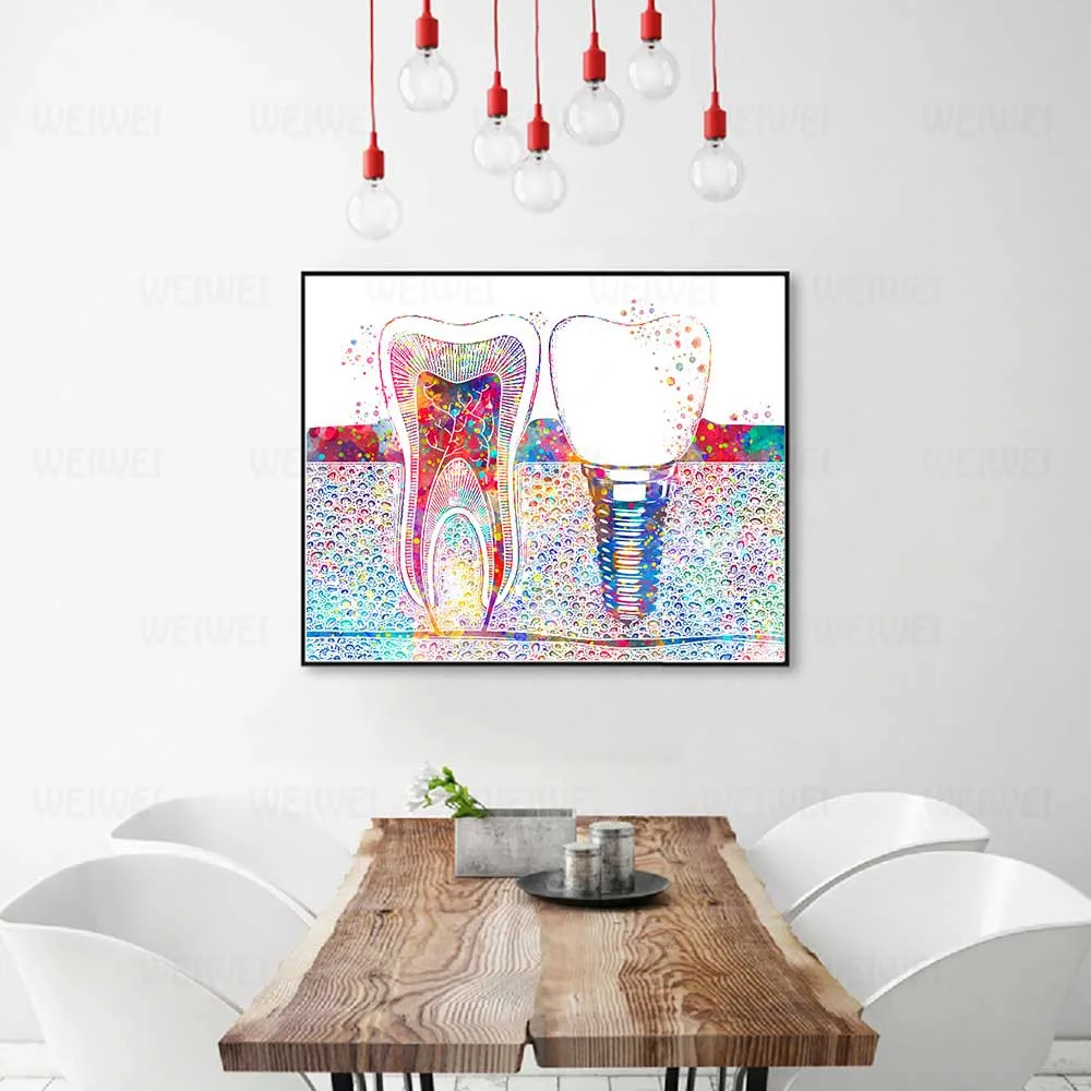 

Dental Art Picture Tooth Implant Canvas Print Dentist Wall Art Painting Medicine Hygienist Poster Tooth Watercolor Clinic Decor