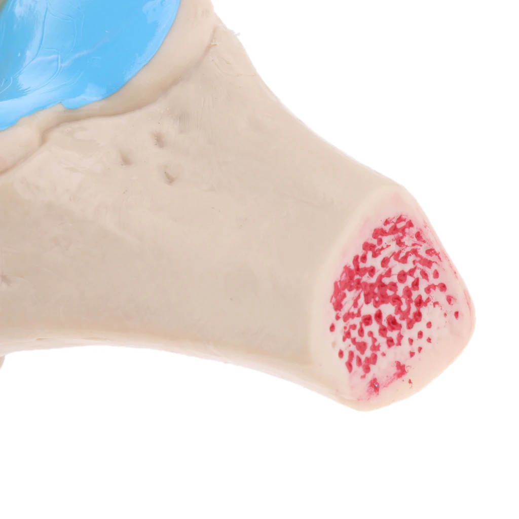 

Human Knee Joint Disease Model Bone Tissue Four Stage Orthopedics Model