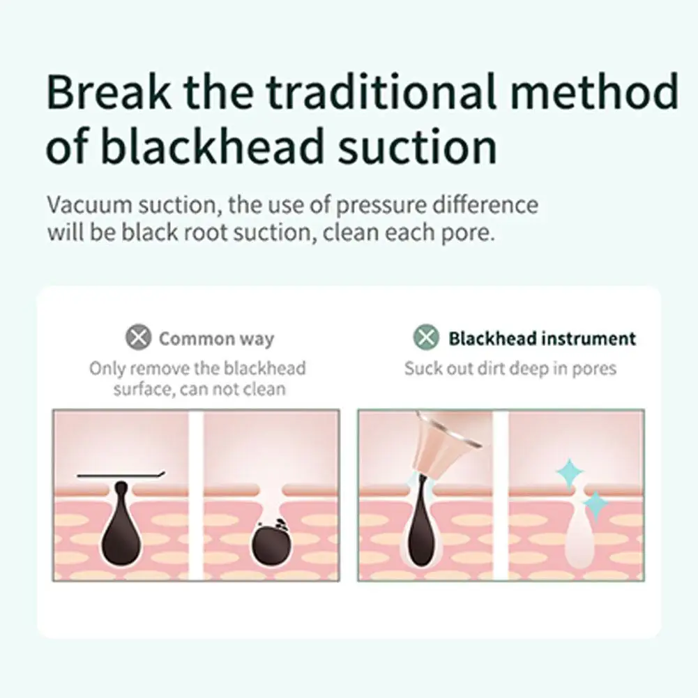 

Electric Visual Blackhead Remover USB Wireless Microscope Camera Pore Cleansing Nose Facials Blackhead Remover Tools