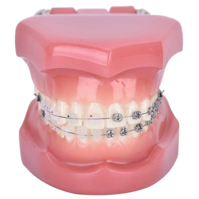 

Teeth Model Implant Disease Teeth Model Dentist Studying Model