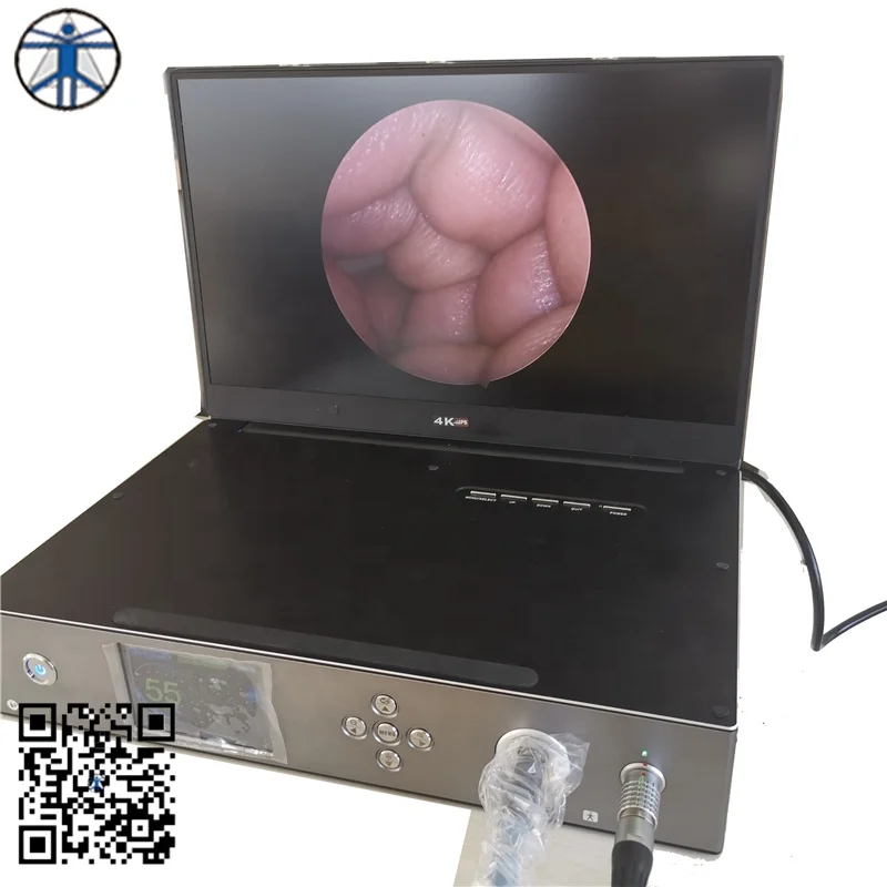 HD medical endoscope camera transforaminal endoscope spine endoscope camera