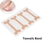 12 шт вросшие ногти свидетельствует об этом облегчение боли коррекция паронихии педикюр эластичная повязка на головку с Стикеры ремонт с закрытым носком для ухода за ногтями