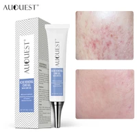 auquest removal cream acne treatment gel effective acne oil control shrink pores whitening moisturizer firming face skin care