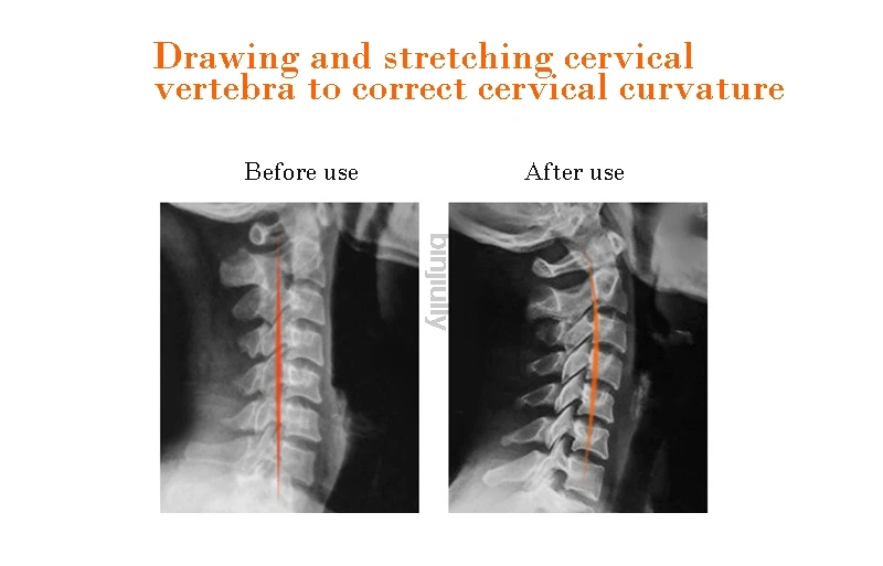 Массажная подушка для шеи и спины с турмалином для лечения болей в пояснице и оздоровления позвоночника