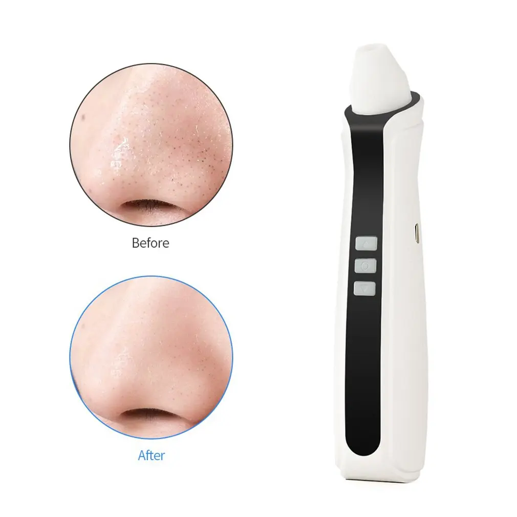 USB перезаряжаемая визуальная угревая камера для удаления пор лица с Черной
