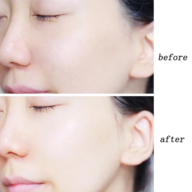 Увлажняющий крем для лица MOPOYAT натуральный отбеливающий увлажняющий лосьон с