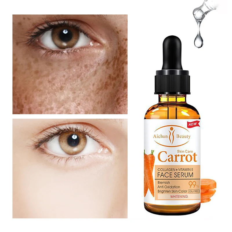 

Whitening Freckle Serum Remove Melasma Acne Spots Dark Spots Pigmentation Nourishing Face Lift Firming Face Deep Skin Care 30g