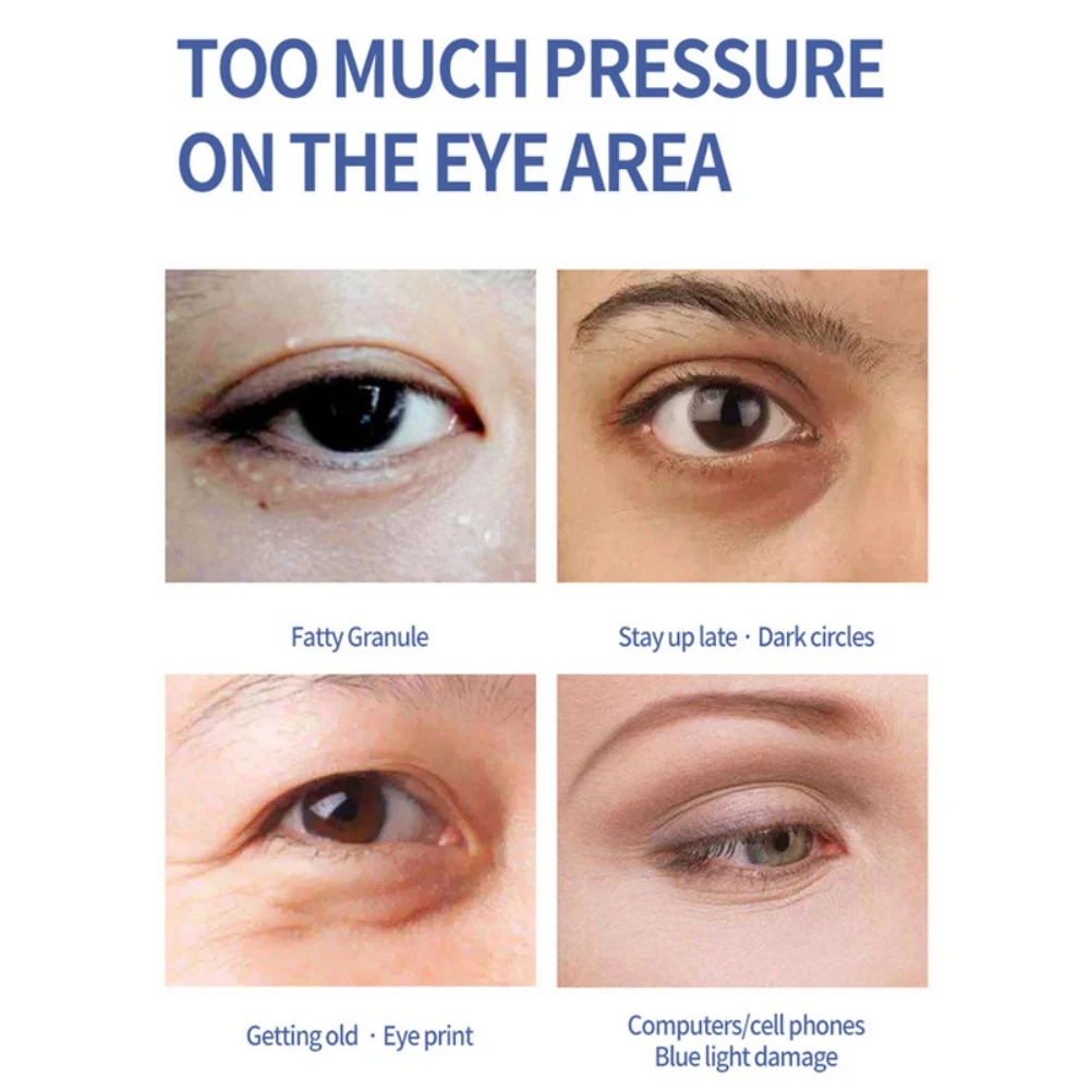 

Fine Lines Remove Eye Bags Eye Cream Tightening Dark Circles Anti Wrinkles Repair Eye Cream