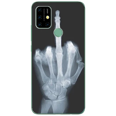 Чехол для UMIDIGI A7 Pro чехол роскошный из ТПУ и силикона s чехол-накладка телефона