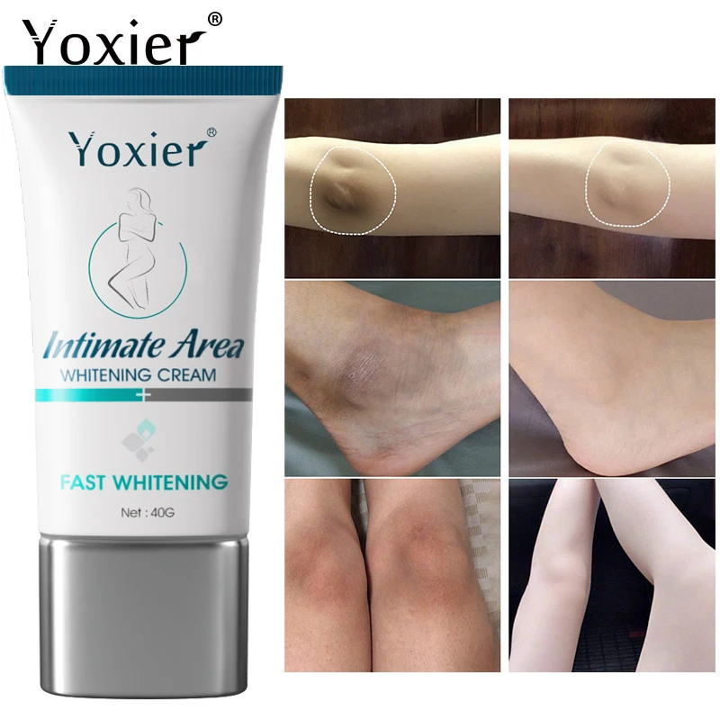 

Intimate Area Whitening Cream Moisturizing Improve Dullness Fades Pigmentation Evenly Divide Skin Tone Relieve Dry Rough Skin