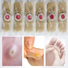 50 шт., пластырь для удаления мозолей