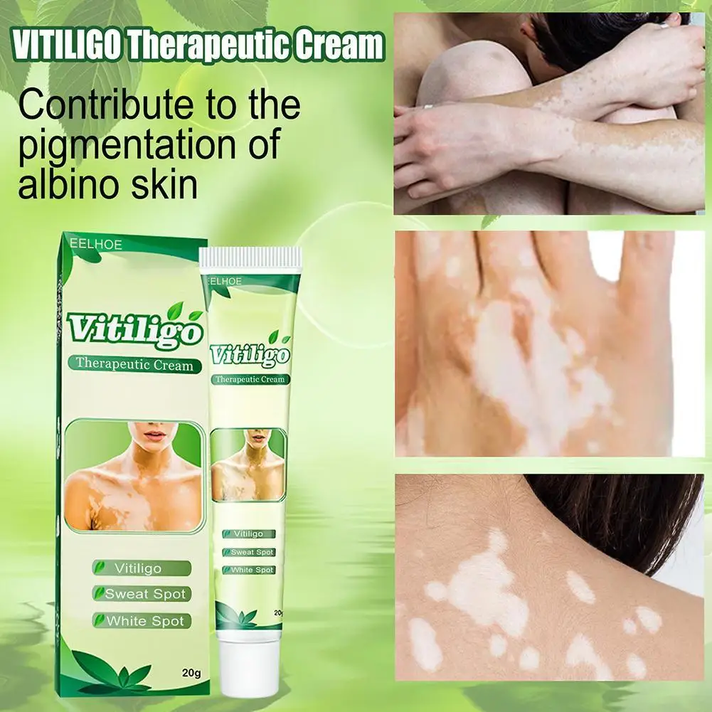 

New Vitiligo Leukoplakia Disease Treatment Ointment Chinese Spot Balm Pigment Medical Repair Melanin Disease Cream White