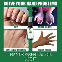 eelhoe hand cream spray moisturizing hydrating repair hand cream spray