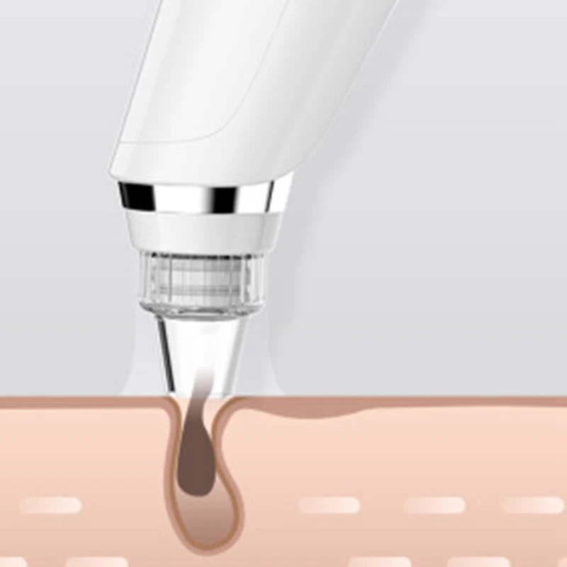 

Color Light Blackhead Removal Instrument Electric Pore Cleaner Home Beauty Instrument