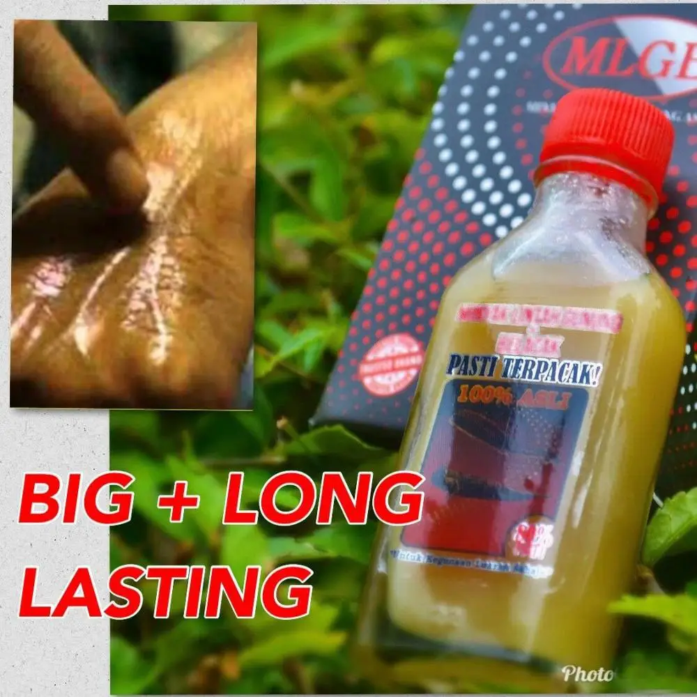 Детали: оригинальный экстракт горного пиявки масло брызговиков для больших +