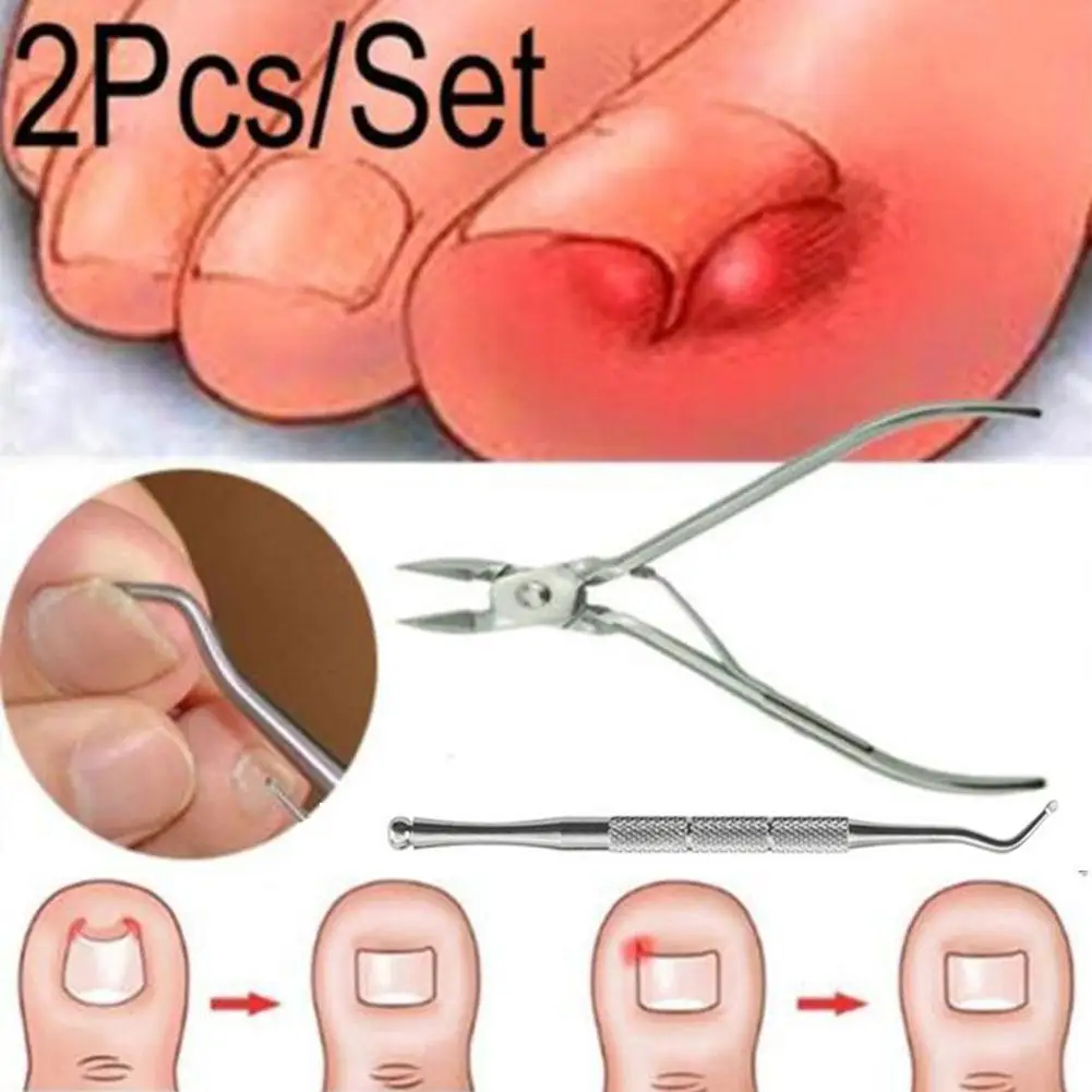 

1/2Pcs Ingrown Toe Nail Correction Pliers Quick Scissors Dead Skin Dirt Remo Nail Clippers Manicure Tool Drop Shipping