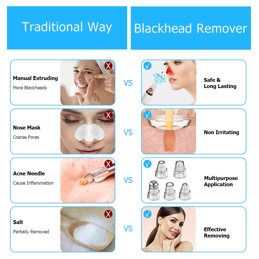 Electric Vacuum Suction Blackhead Remover USB Rechargeable Facial Clean Pore Cleaner WiFi Wireless Camera Monitor Black Head | Красота и