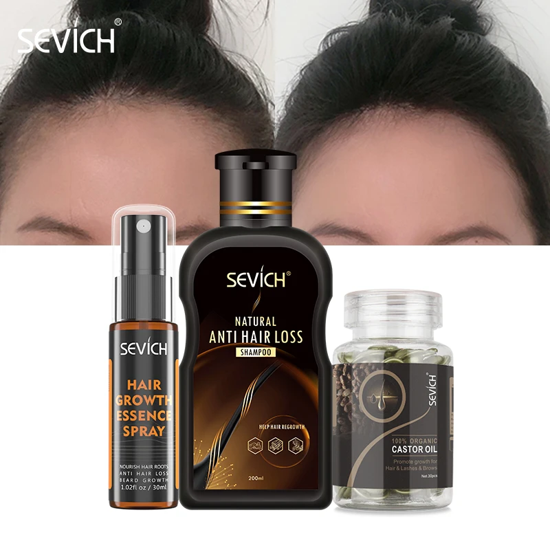 

Sevich Hair Loss Treatment Set 30ml Hebal Fast Hair Growth Spray 200ml Ginger Anti-Hair Loss Shampoo Castor Oil Hair Capsule