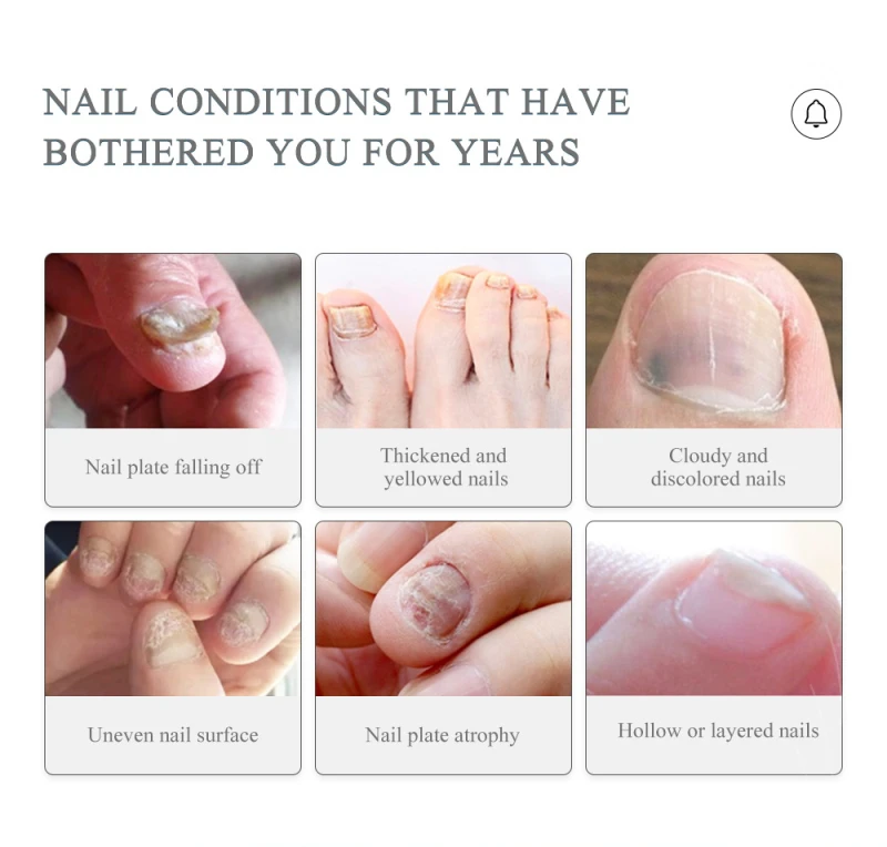 

New 10ml Nail Repair Gel Pen Repair Liquid Foot Fungus Nail Disorders Smooth Healthy Nails TSLM1