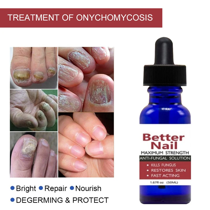 50ml Nail Repair Liquid Anti Fungus Toe Serum Remove Onychomycosis Essence Treatment Hand Foot Care ZGO | Красота и здоровье