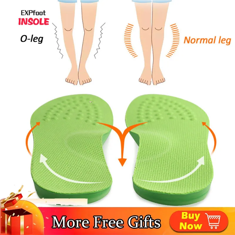 

VAIPCOW O/X-Leg Orthopedic Insoles Arch support insole corrigibil Bow Legs Valgus Varus Massaging Shoe pads Beauty Leg Feet Care