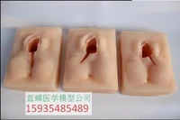 vulva suture practice model perineum suture practice module gynecology and obstetrics suture skill training model