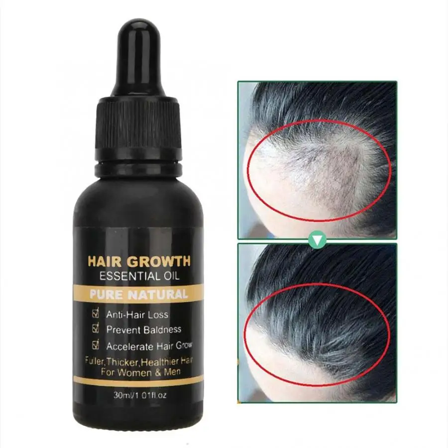 

Promote Hair Growth Hair Growth Essential Oil Anti-Hair Loss Hair Nourishing Repairing Hair Care Oil Hair Products Deep Repair