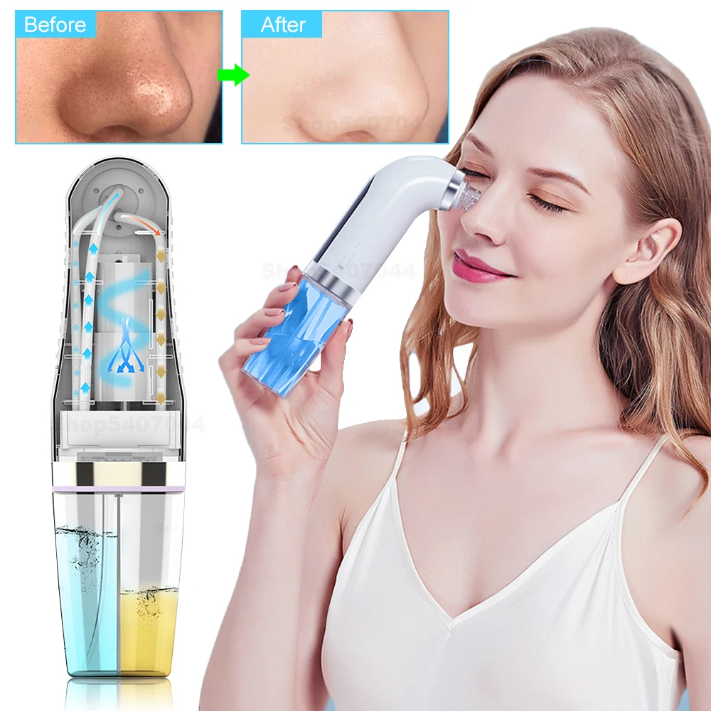 

Electric Bubble Blackhead Remover Water Cycle For Acne Pimple Removal Vacuum Suction Facial Pore Cleaner Beauty Device