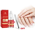 Жидкость для восстановления ногтей, удаление грибка ногтей, против онихомикоза, уход за ногами, питание, осветление ногтей, уход за ногтями, инструменты для ногтей