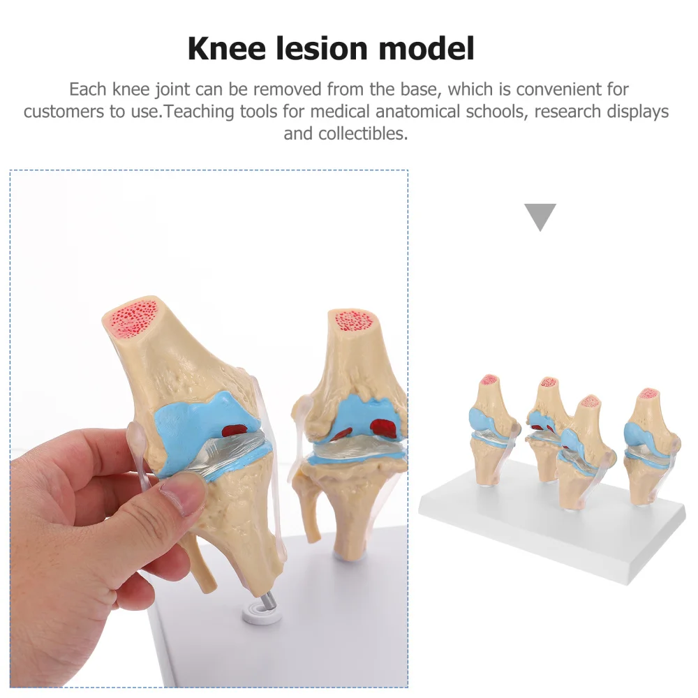 

Anatomical Knee Joint Model Set Knee Anatomical Model for Kids Learning Display