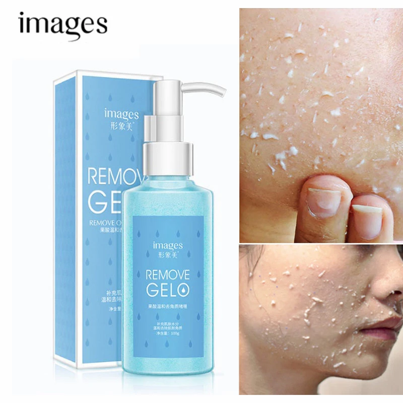 

Fruit Acid Exfoliation Exfoliating Peeling Gel Facial Scrub Deep Clean Acne Blackhead Cleanser Whitening Oil Control Skin Care