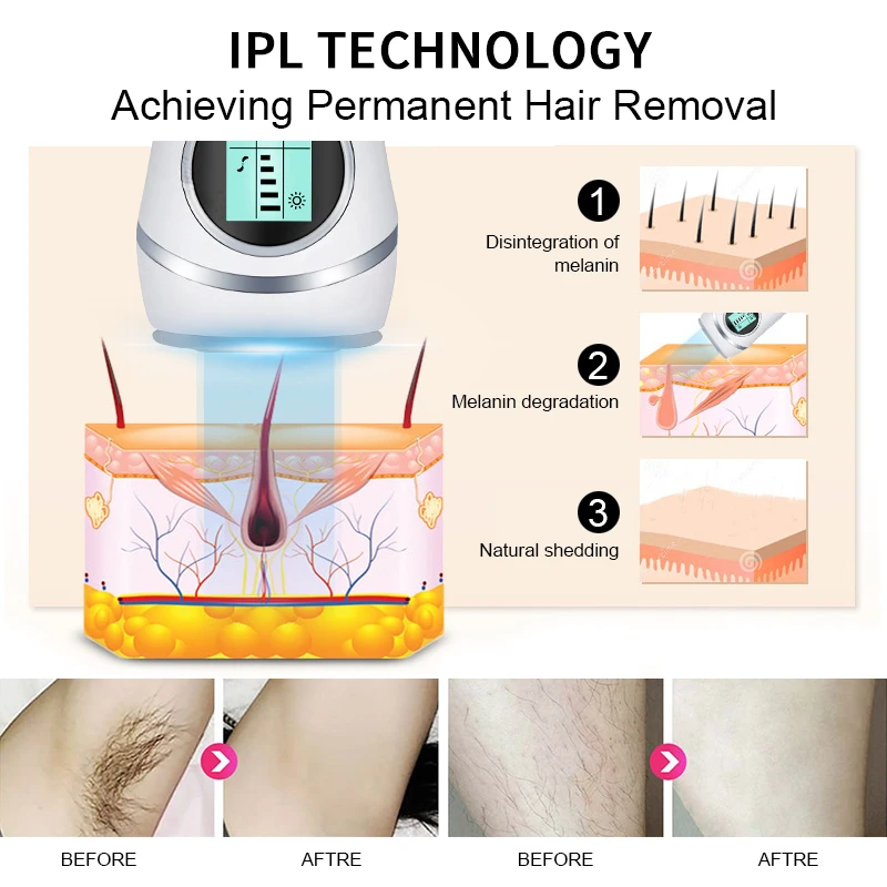 IPL эпиляция лазерная эпиляция Эпилятор светодиодный дисплей Фотоэпилятор женский эпилятор для депиляции лица эпилятор