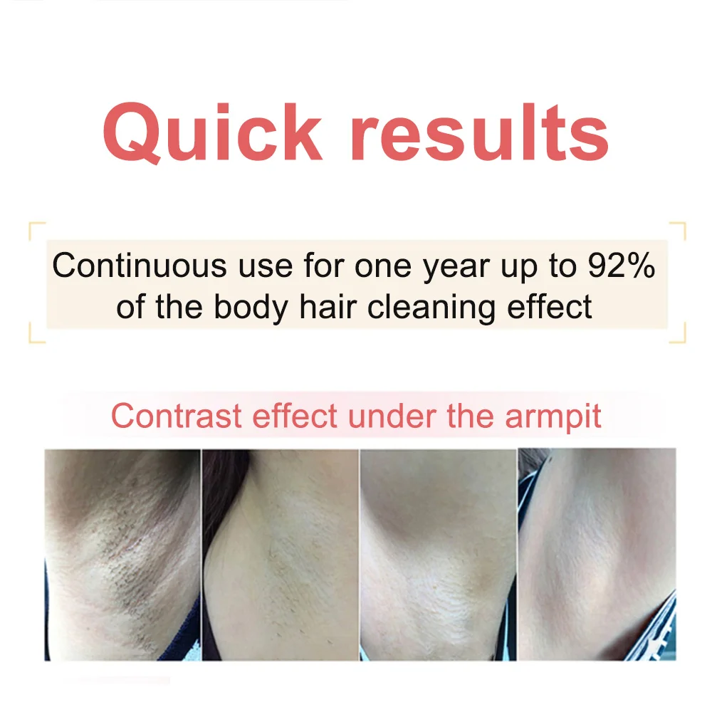 

3 In 1 900000 Flashes Laser Epilator Permanent IPL Hair Removal Photoepilator epilator for women depiladora Painless Epilator