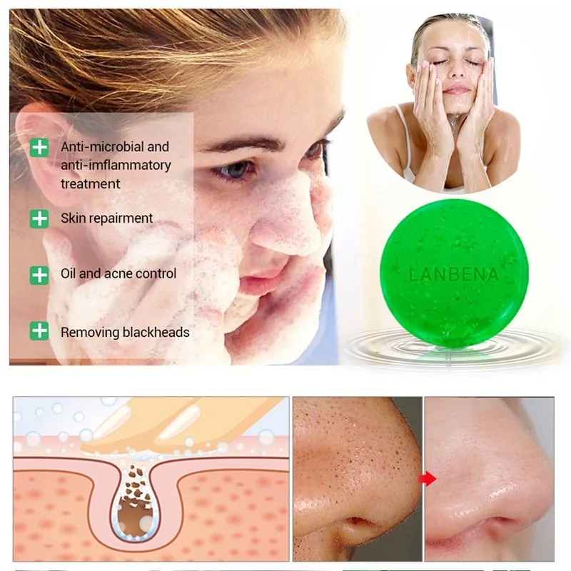 Натуральный чай искусственное кожу лица мыло с глубокой очисткой черных точек