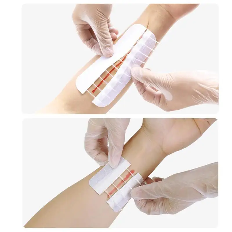 

1pc Zipper Band-aid Painless Wound Closure Device Without Wound Dressing Aid Suture Reducer Needles Suture-free Band Zip Pa M5V9