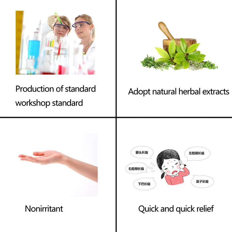 Увлажняющий отбеливающий крем для лица удаления акне бактерицидное удаление