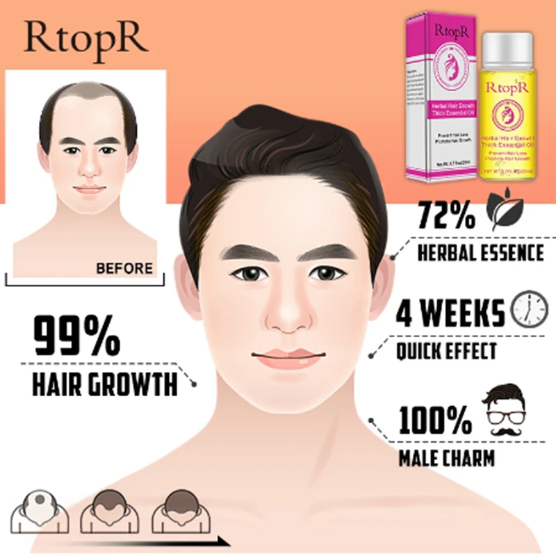 Травяное средство для роста волос жидкость против выпадения быстрого густых