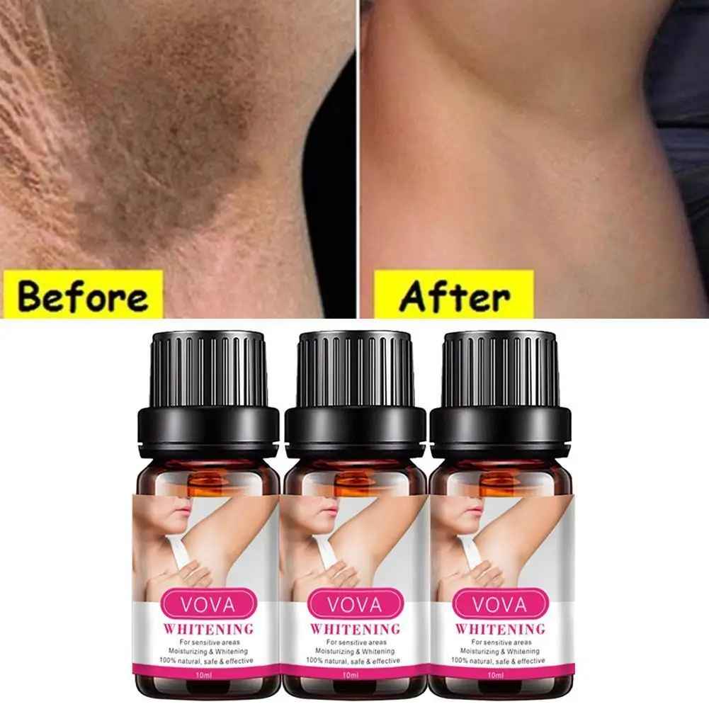 

10ml Armpit Whitening Oil Skin Lightening Bleaching Cream Underarm Knees Body Oil Dark Skin Whitening Essential Legs Intima I0J7