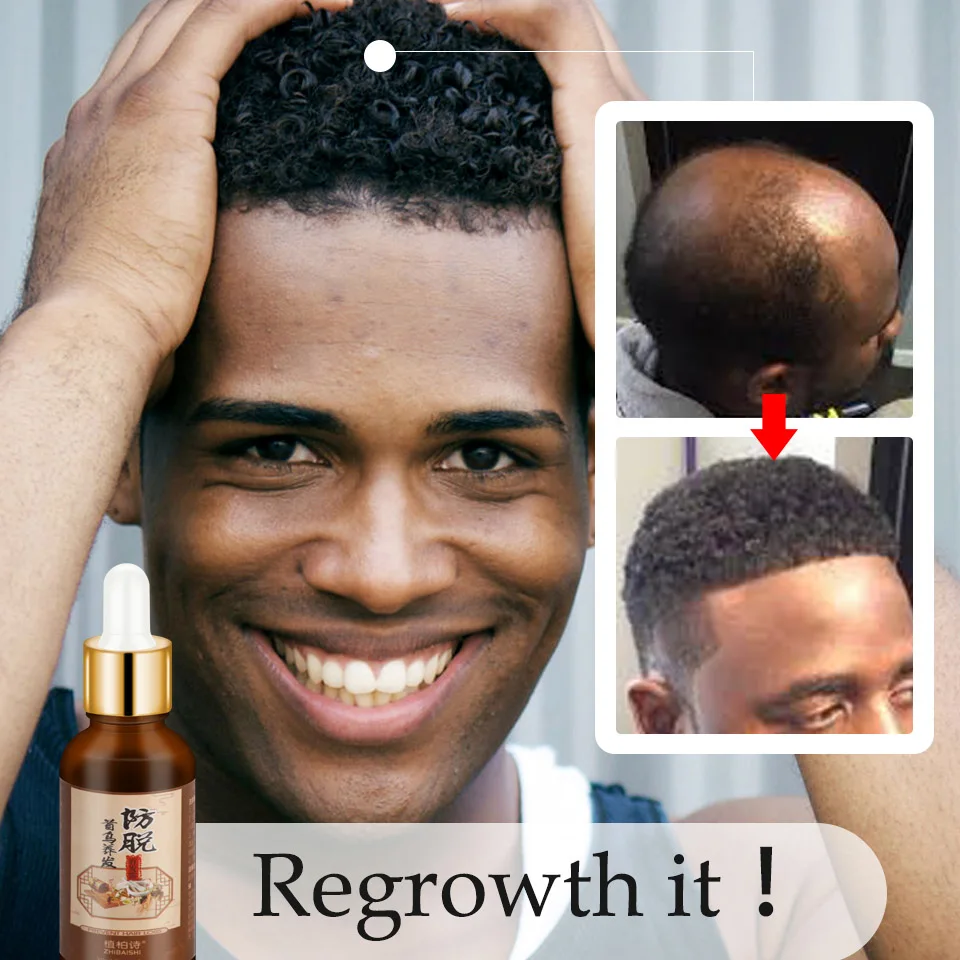 2 шт. масло для роста волос лечения выпадения бороды тоник | Красота и здоровье