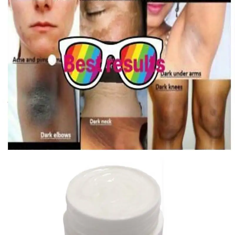 

ORIGINAL SKIN WHITENING Vitamin B3 BEAUTY CREAM WITH AVOCADO&ALOEVERA FREE SHIPPING