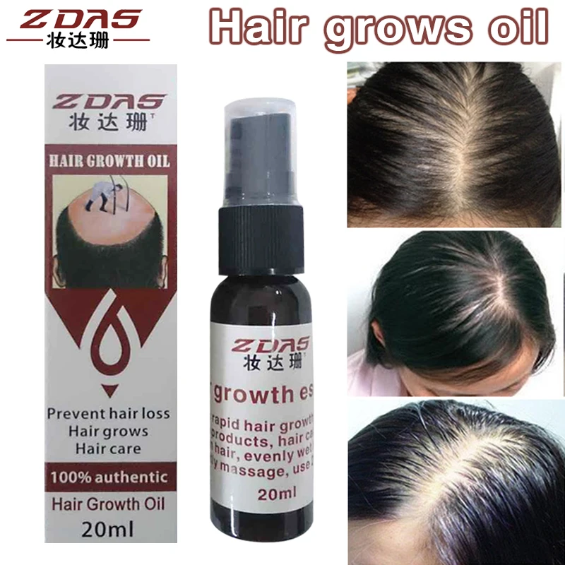 

Травы для волос продукты для потери волос сыворотка для быстрого роста волос жидкость yuda пиляция против роста кондиционер эфирное масло спрей