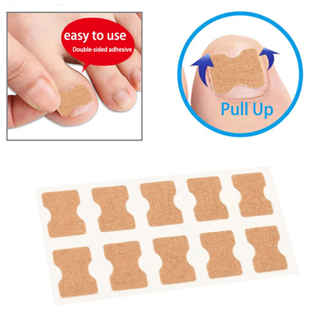 

10/50/100pcs Toenail Correction Pedicure Tool Toenail Patch Ingrown Toe Inlay Nail Corrector Nail Patch Correction Stickers