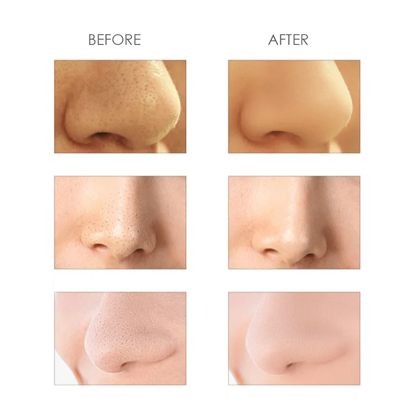 Уход за кожей шеи Массаж ног терапия электронное тело для похудения импульсный