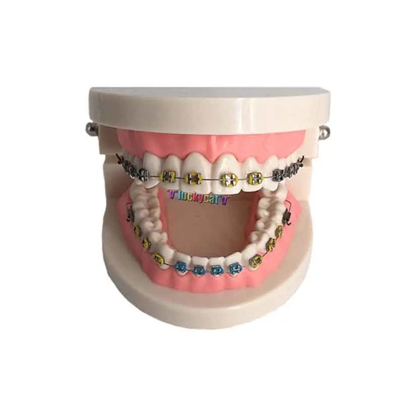 Металлическая Стоматологическая Ортодонтическая модель для лечения зубов с