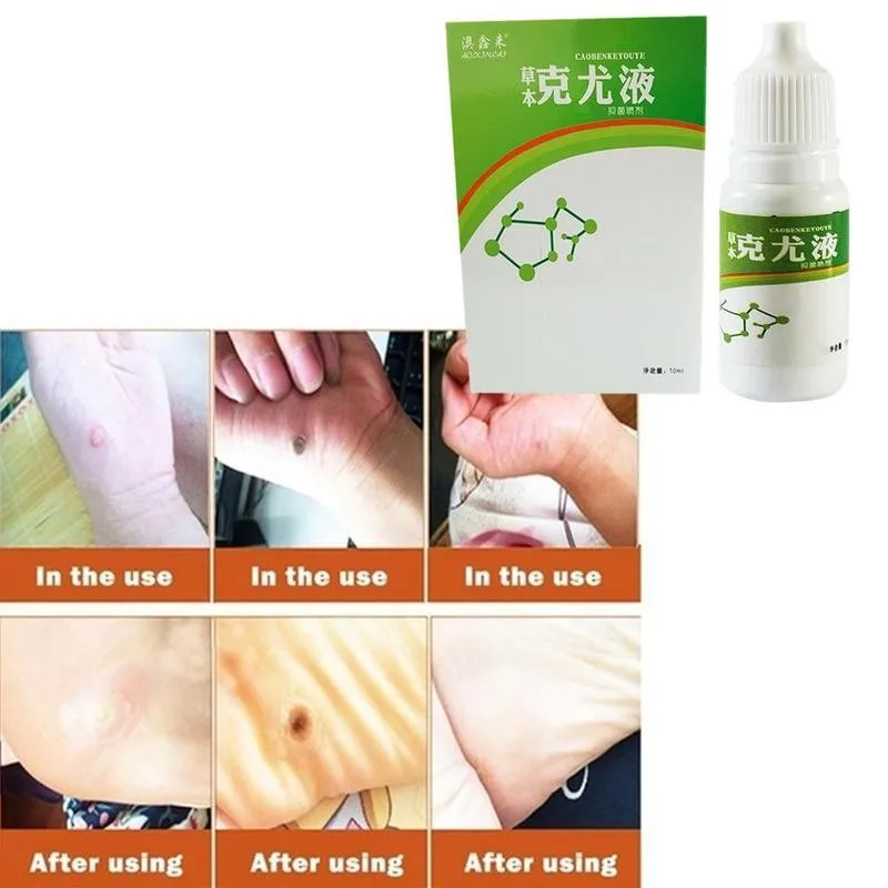 10 мл женских половых органов для борьбы с пигментацией лечение папилломы